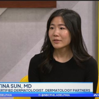 Tips on Preventing Skin Cancer and Protecting Your Skin